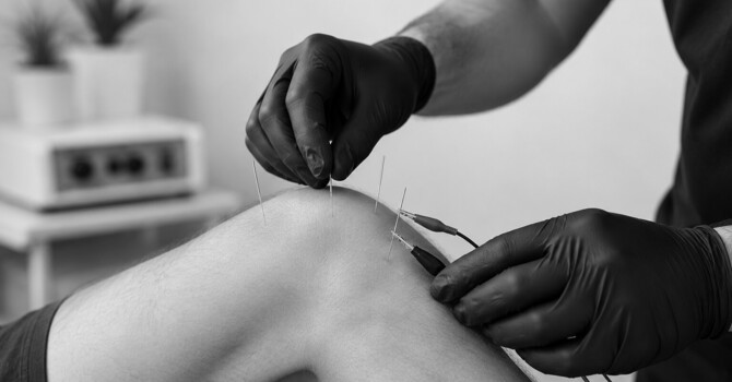 Dry Needling